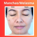 Kit Skincare Mousse Limpeza Facial Vitamina C+Sérum Clareador Dermachem